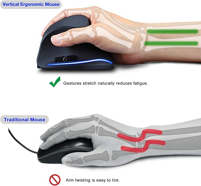 TRELC Ergonomic Mouse, 2.4G Wireless Vertical Optical Mouse